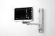 Монітор пацієнта uMEC120 МП-0022 фото 6
